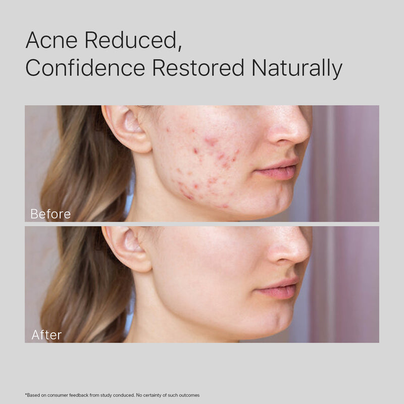2% Salicylic Acid Face Cleanser