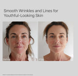 0.3% Retinol Acid Face Serum