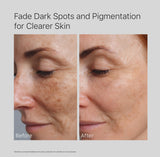 2% Alpha Arbutin Face Serum