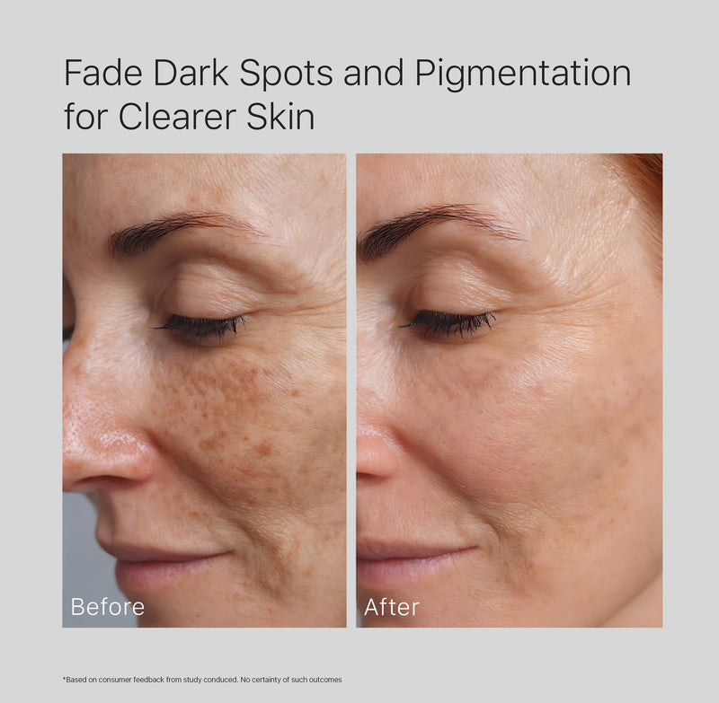 2% Alpha Arbutin Face Serum