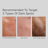 2% Alpha Arbutin Face Serum