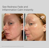 10% Niacinamide Face Serum