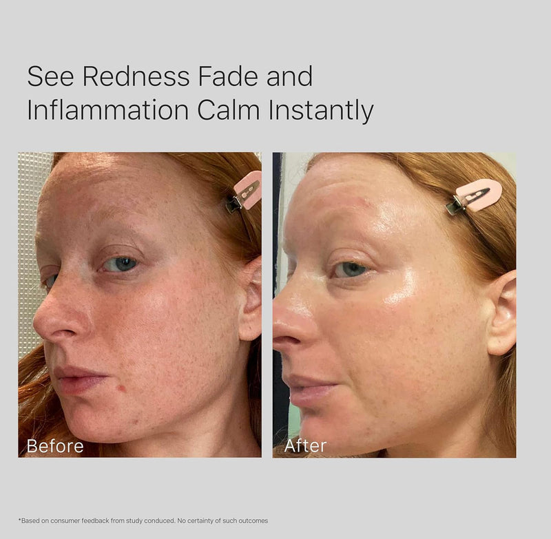 10% Niacinamide Face Serum