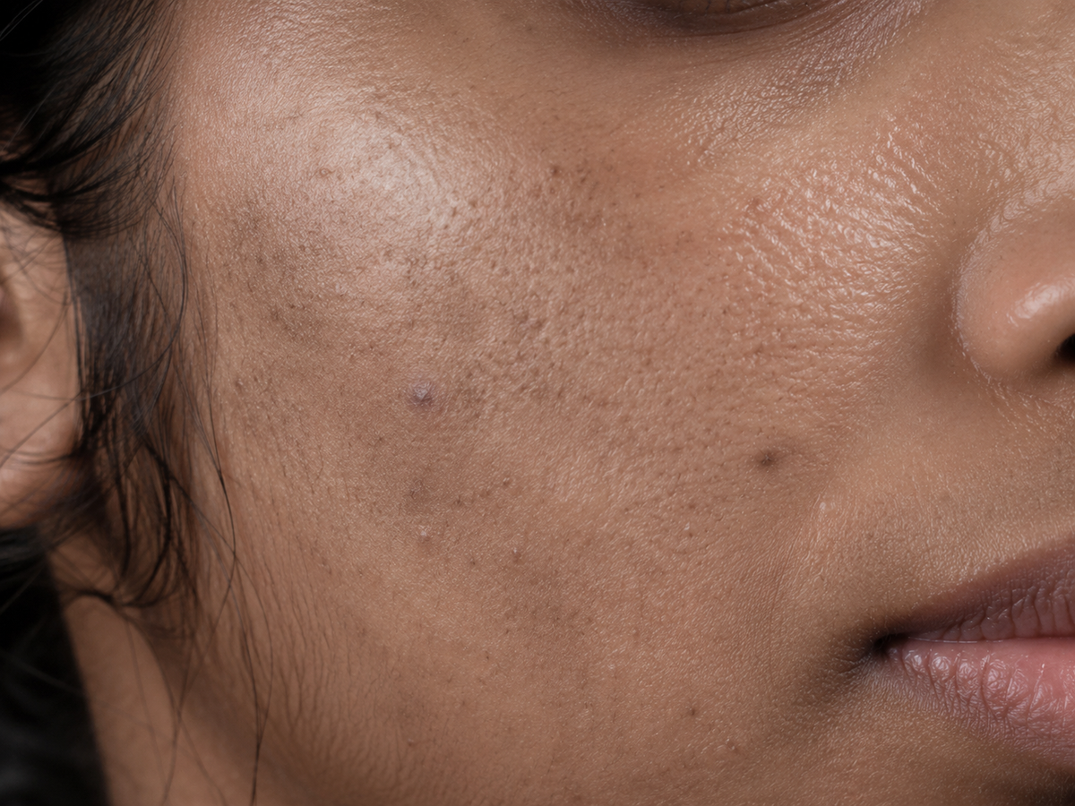 Dull Skin