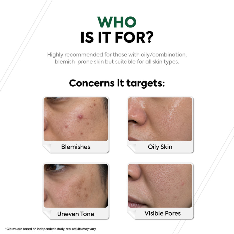 10% Niacinamide Face Serum