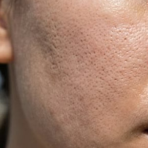 Uneven Tone